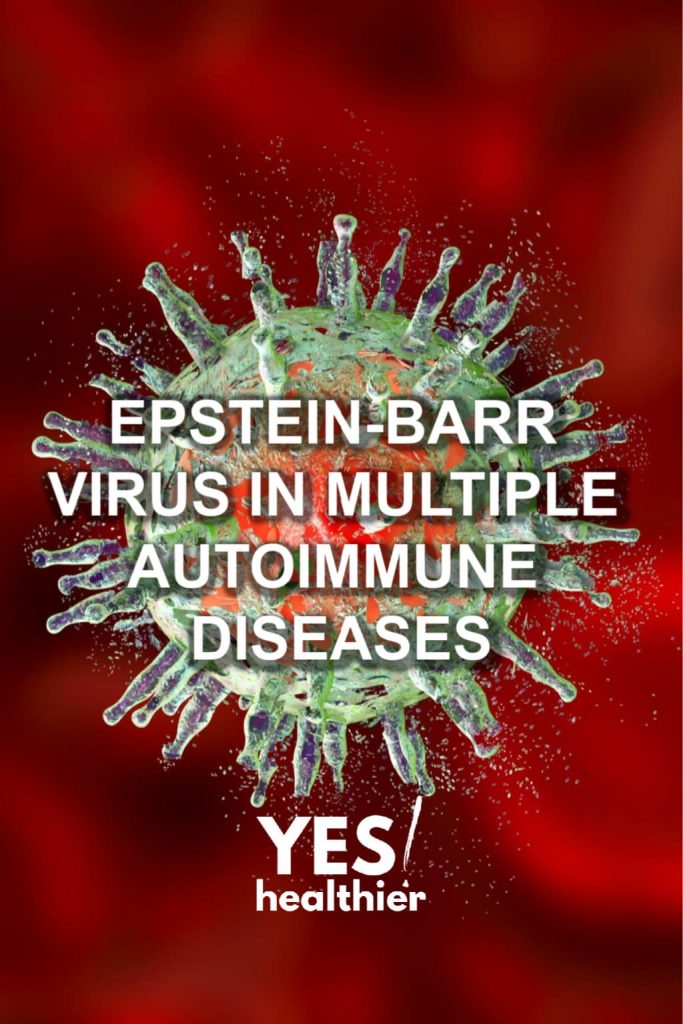 Epstein-Barr Virus Detected In Multiple Autoimmune Diseases - Yes Healthier