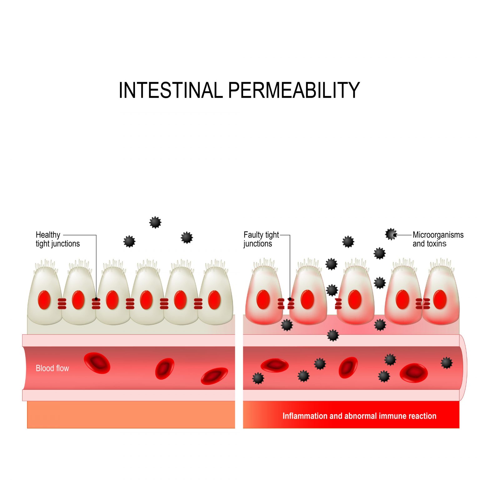 Fix Your Gut Lining. Fix Your Health. Yes Healthier