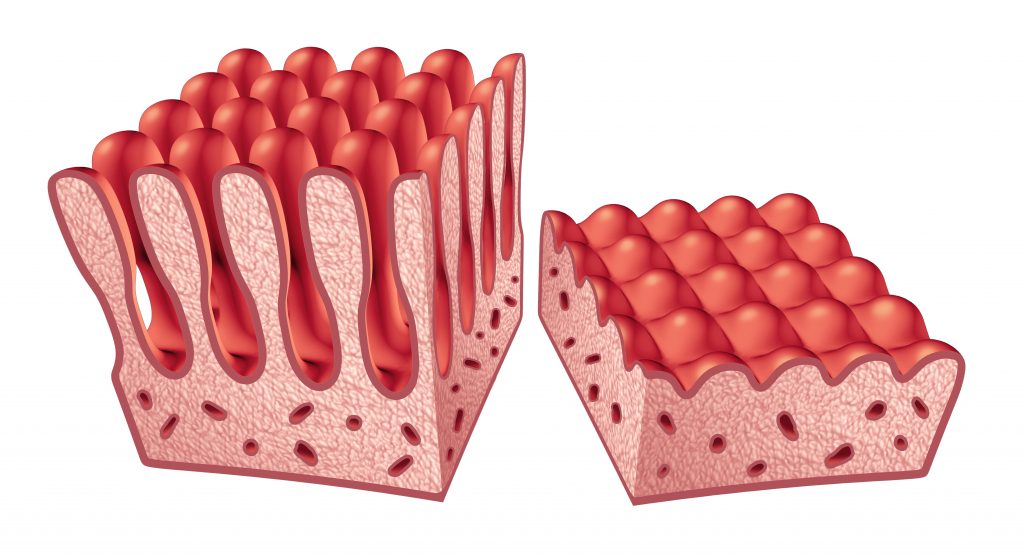 The curvaceous small intestine and better health